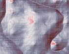 als scan models
